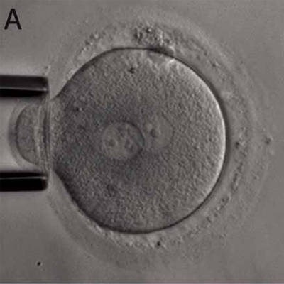 1-cell-embryo.png