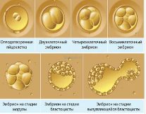 Качество эмбрионов седьмых суток развития после обновления среды на шестые сутки: проспективное исследование