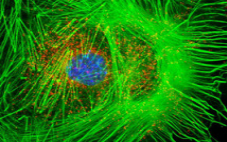 Флуоресцентная визуализирующая микроскопия живых клеток (FLIM) выявляет различия в метаболических сигнатурах эуплоидных и анеуплоидных бластоцист человека